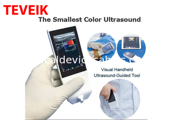 Punta de prueba inalámbrica portátil del ultrasonido de Android de Wifi de la máquina médica del ultrasonido linear