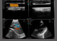 Punta de prueba inalámbrica 3 del ultrasonido de las cabezas dobles en 1 color linear convexo cardiaco Doppler